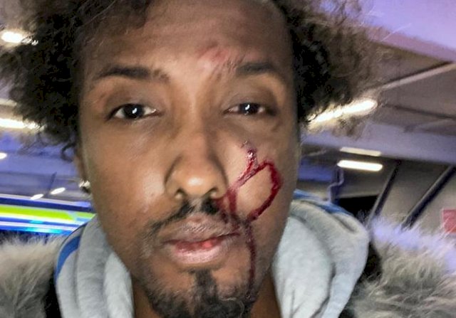 Care worker 'kicked in the face' by police who mistook him for a wanted man in Sheffield - Voice Online