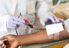 Breakthrough in sickle cell treatment