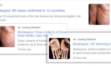 Journalists blast media for using images of black people for European outbreak of monkeypox