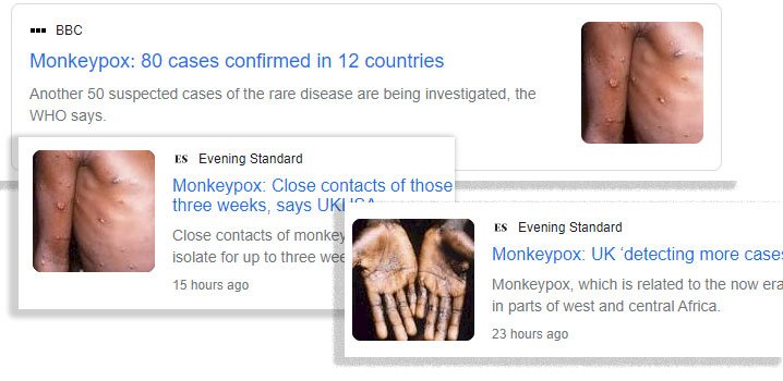 Journalists blast media for using images of black people for European outbreak of monkeypox