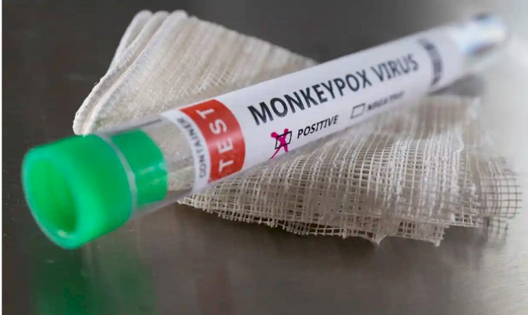 Jamaica confirms first case of monkeypox
